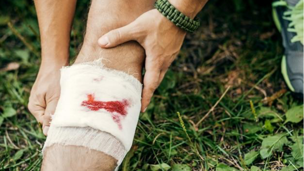 Wound Care Dos and Don'ts How to Better and Faster Treat the Wounds