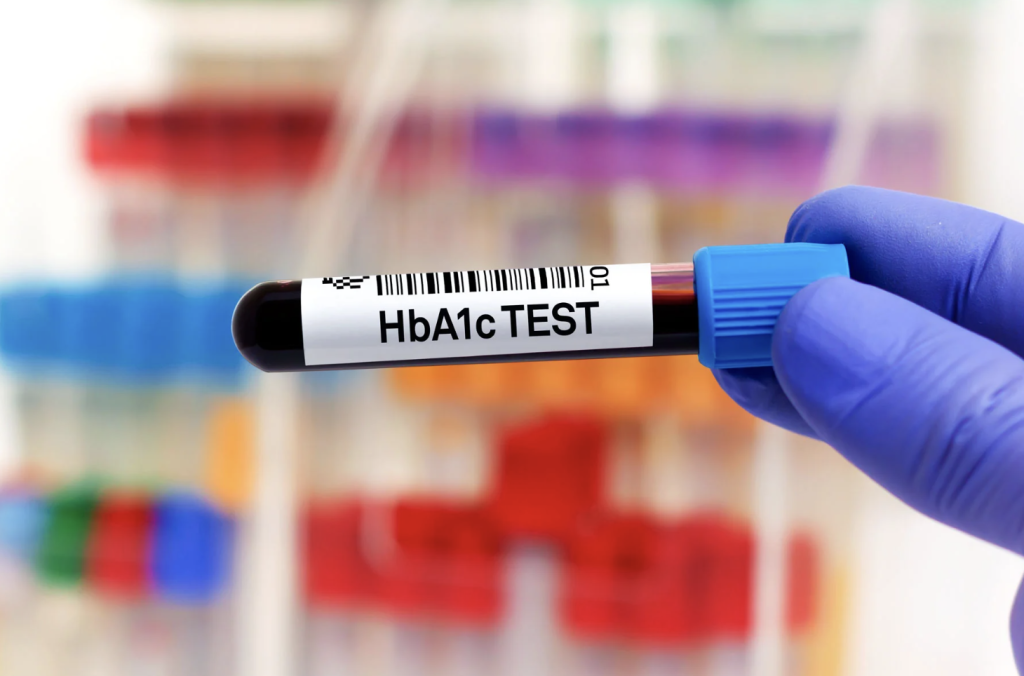 The Impact of Stress Management on HbA1c Levels