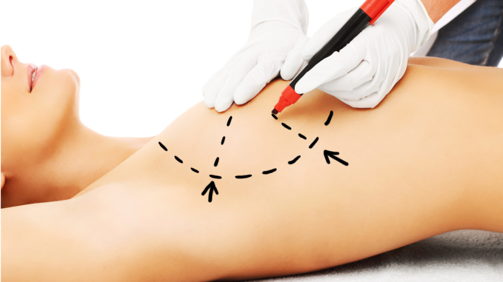 Breast Plastic Surgery in Colombia Fast, Precise, and Without Unnecessary Pain