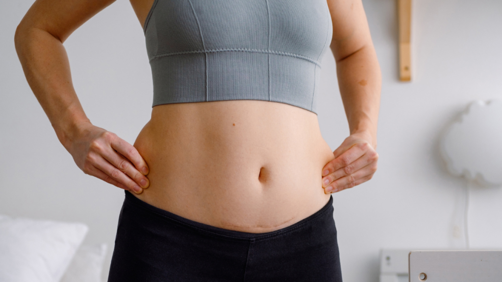Mommy Makeover Risks and Benefits Is It Worth It?