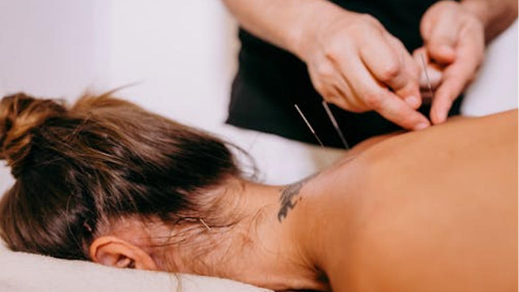 3 Top Reasons Why Dry Needling is a Good Idea